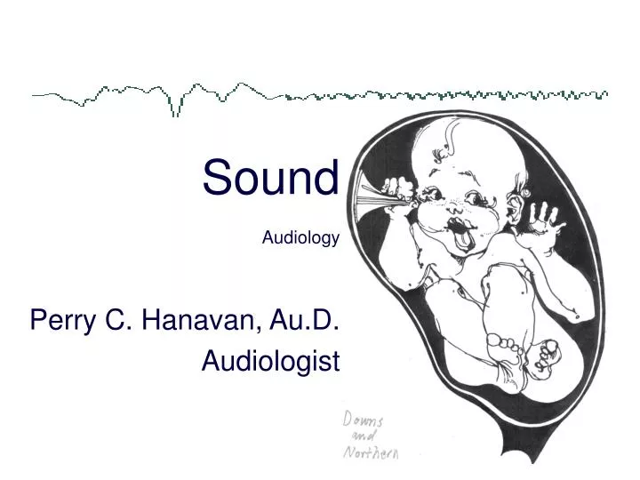 sound audiology n.