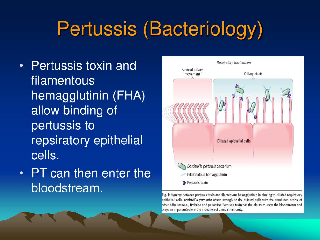 PPT  PERTUSSIS PowerPoint Presentation, free download  ID202491