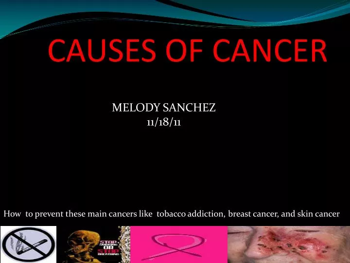 causes of cancer n.