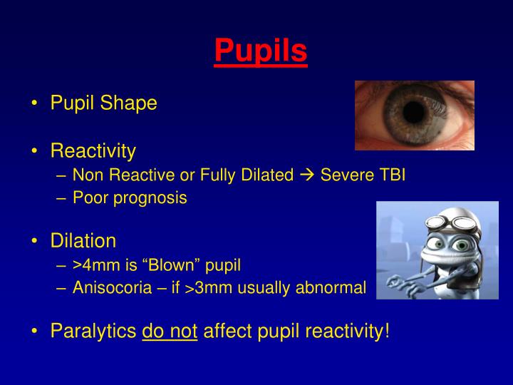 subdural hematoma blown pupil subdural hematoma blown pupil
