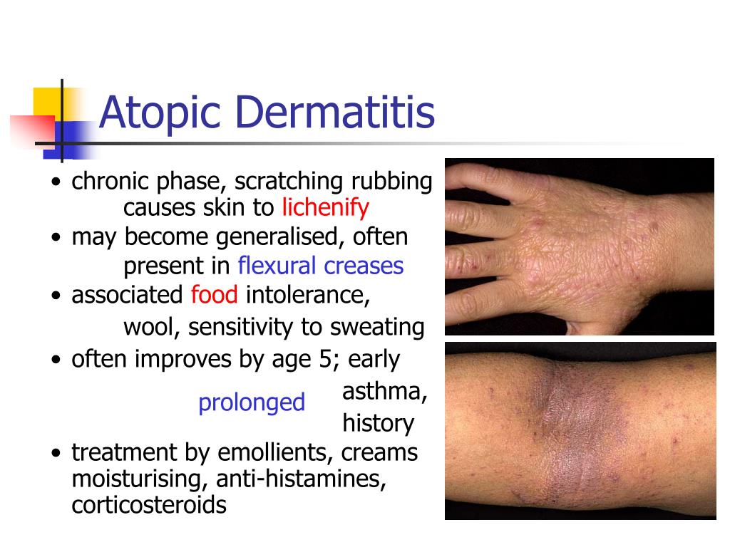 Ppt Non Infectious Skin Diseases Powerpoint Presentation Free