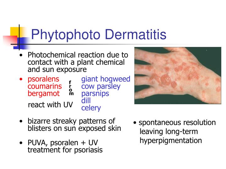 PPT - Non-Infectious Skin Diseases PowerPoint Presentation - ID:210732