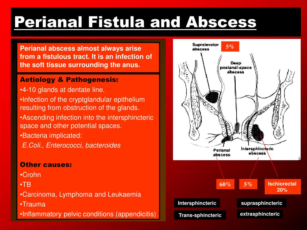 Ppt Benign Anorectal Abscess And Fistula Powerpoint Presentation My