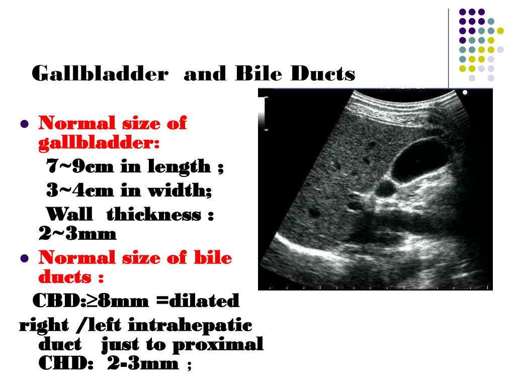 Normal Common Bile Duct Ultrasound