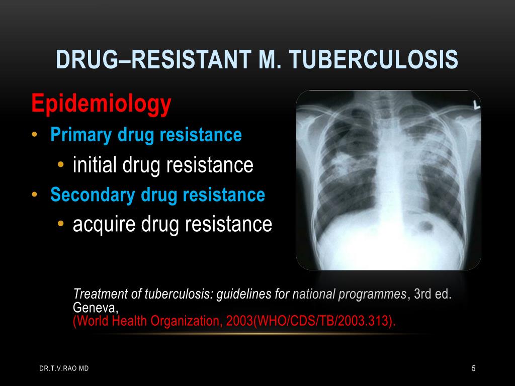 Ppt Multidrug Resistant Tuberculosis Powerpoint Presentation Free Download Id 220006