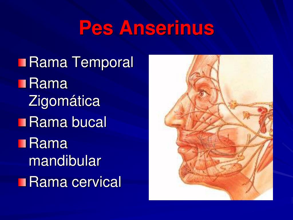 PPT - PARALISIS FACIAL PowerPoint Presentation, free