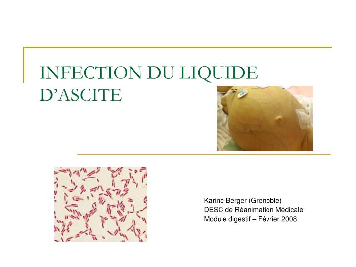 Ppt Infection Du Liquide Dascite Powerpoint Presentation Id 223047