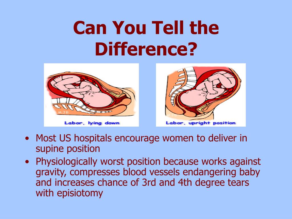 PPT - Labor and Delivery PowerPoint Presentation, free ...