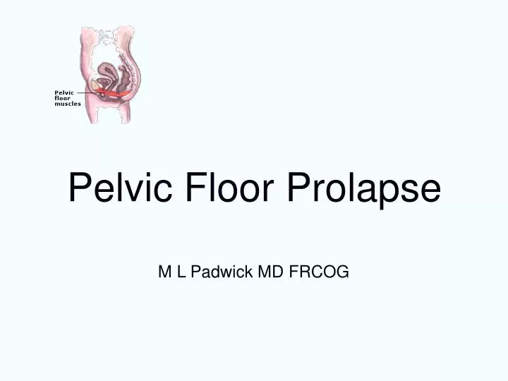 pelvic floor prolapse n.