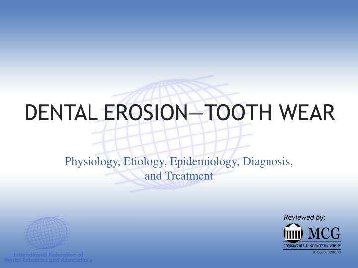 dental erosion tooth wear n.
