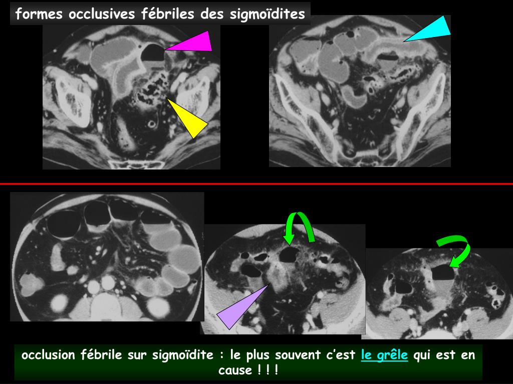 PPT - points clés et pièges du diagnostic des syndromes douloureux et ...