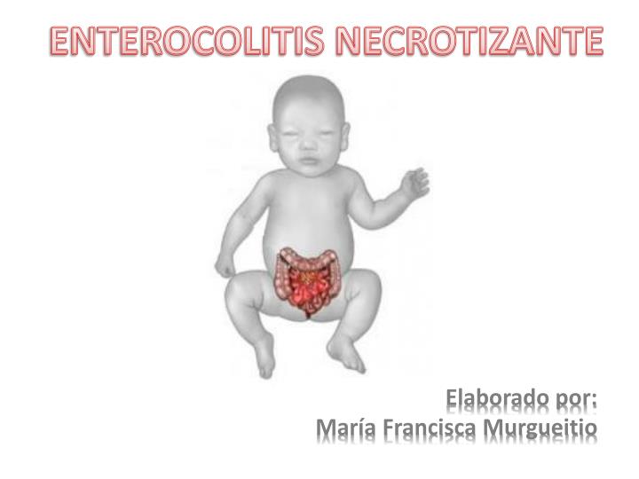 enterocolitis necrotizante n.