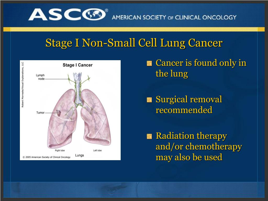 presentation of non small cell lung cancer