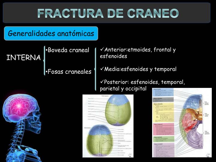 PPT - Fractura de Cráneo PowerPoint Presentation - ID:231055
