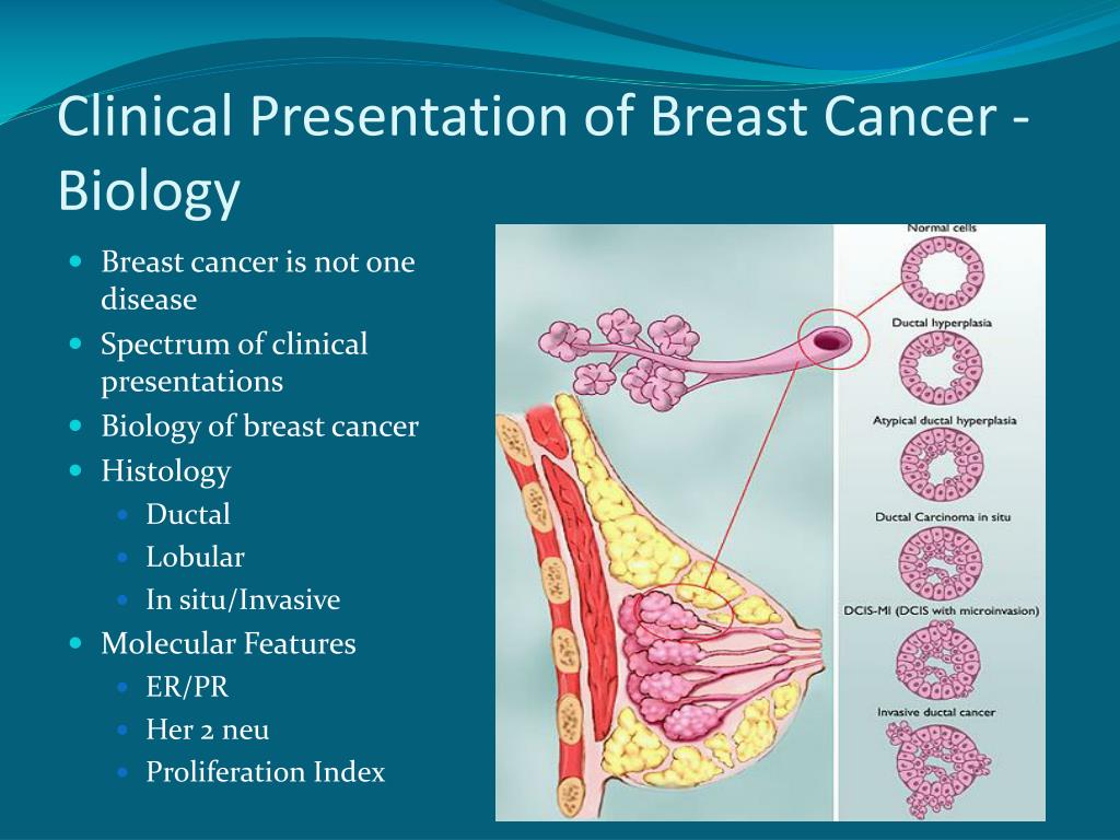 I am cancer. Cancer Biology. Cancer in situ морфологические особенности.