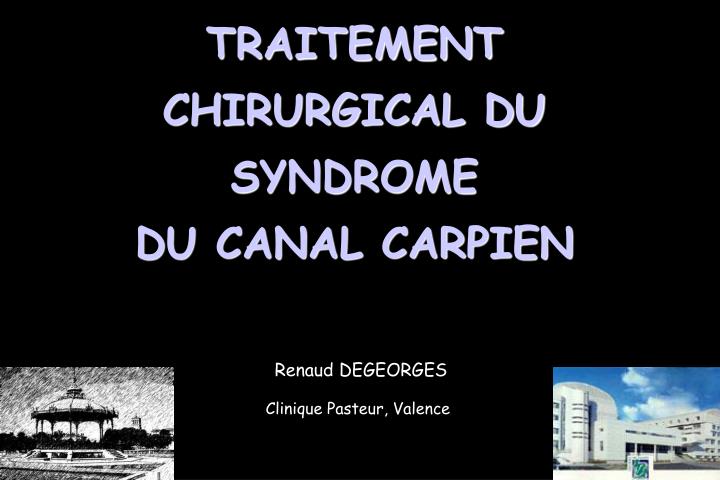 traitement chirurgical du syndrome du canal carpien n.