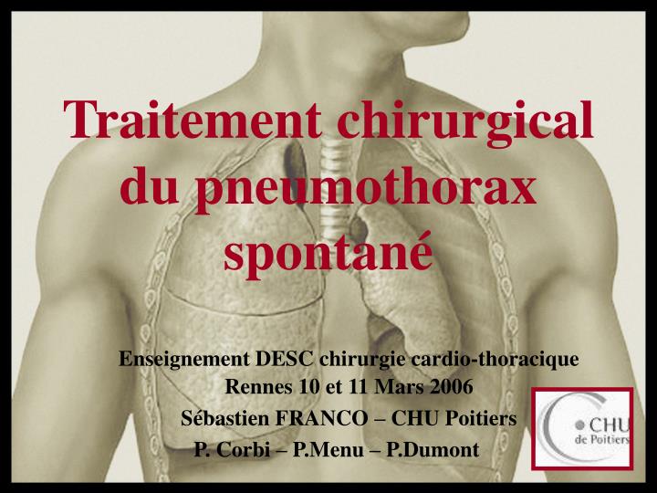 PPT - Traitement chirurgical du pneumothorax spontané ...