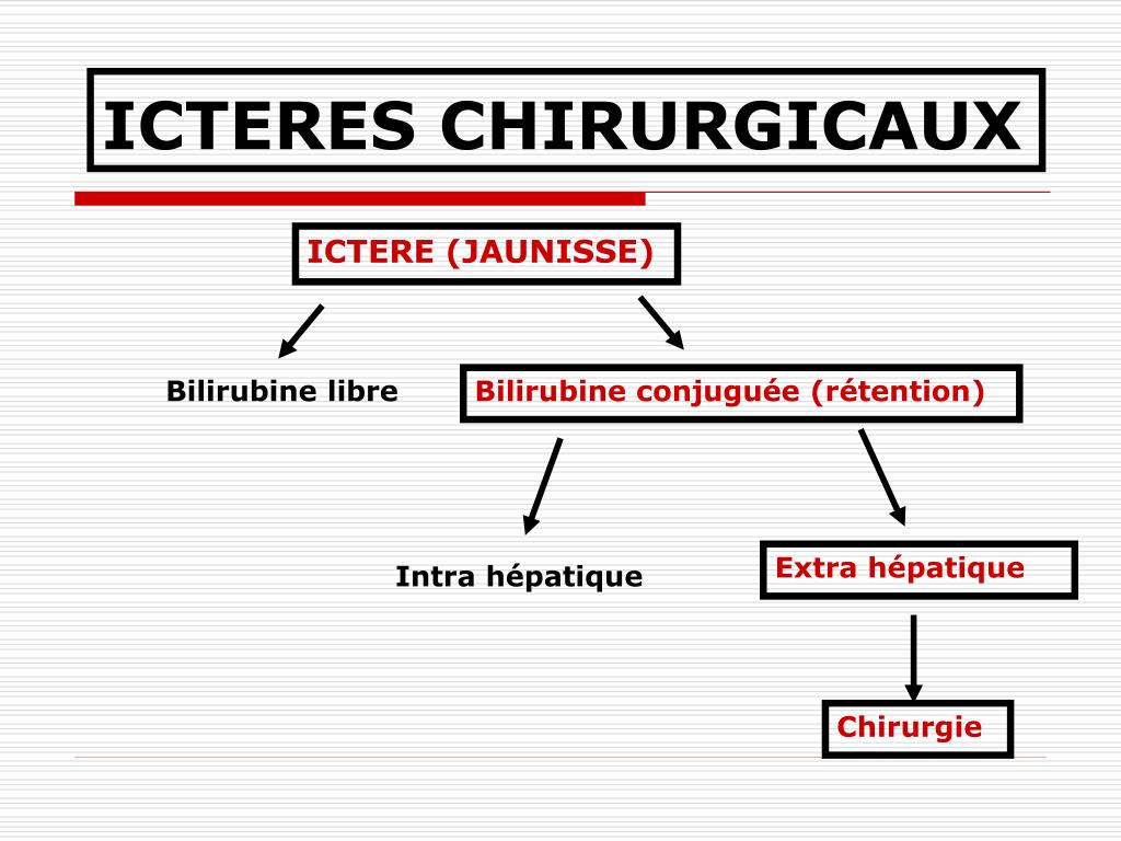 Ppt Icteres Chirurgicaux Powerpoint Presentation Free Download Id 235203