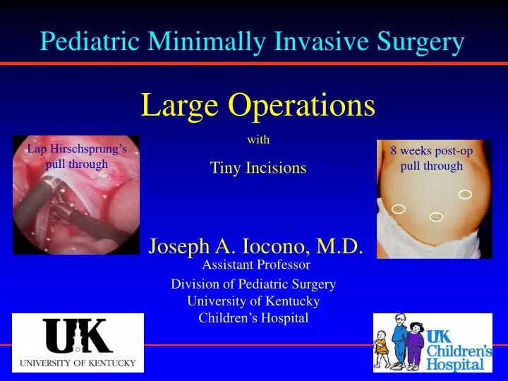 pediatric minimally invasive surgery n.