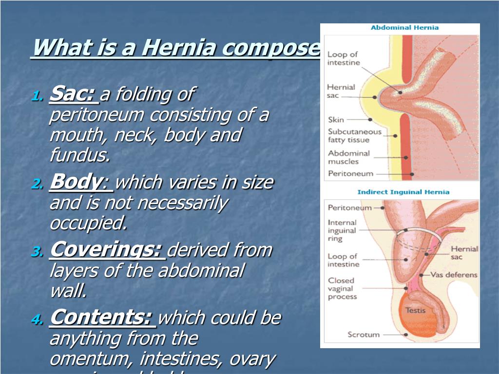 Ppt Hernias Powerpoint Presentation Free Download Id236632