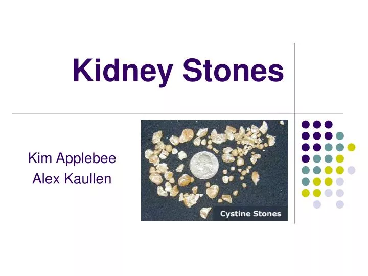 kidney stones n.