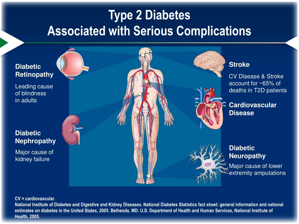 presentation of diabetes type 2