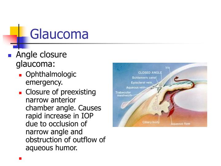 PPT The Differential Diagnosis of The Red Eye PowerPoint Presentation