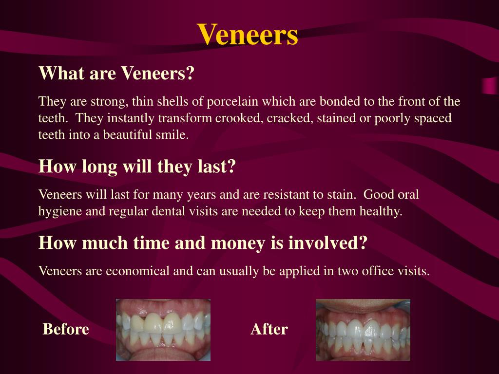 PPT Dental Health Care Associates Experience the Difference… 5000