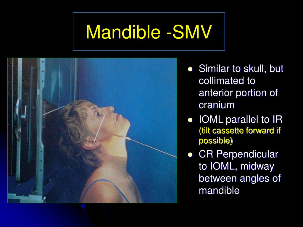 PPT - The mandible is the largest , densest bone of the face PowerPoint