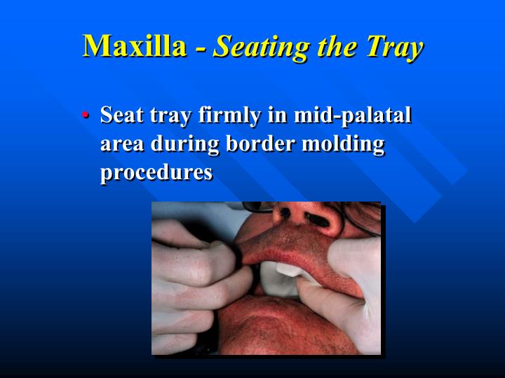 PPT Border Molding PowerPoint Presentation ID249794