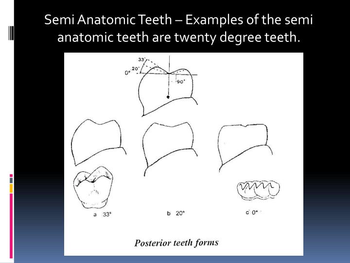 PPT Principles of occlusion in complete denture PowerPoint Presentation ID249940