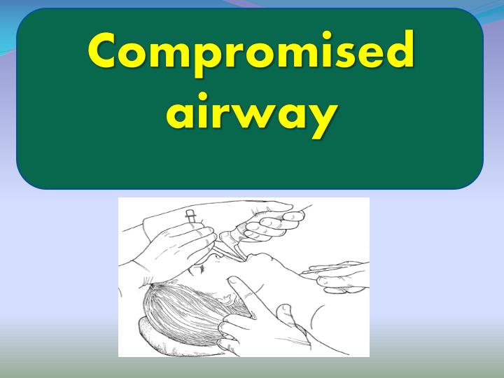 PPT Compromised airway PowerPoint Presentation, free download ID257336