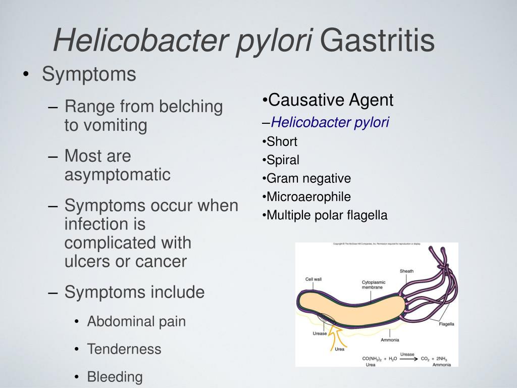 Síntomas helicobacter pylori cansancio