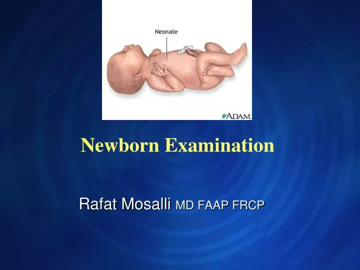 newborn examination n.