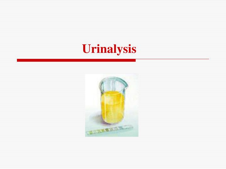PPT Urinalysis PowerPoint Presentation, free download ID261834