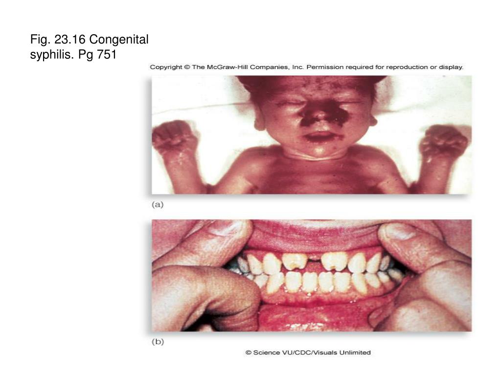 PPT - Chapter 23, Genitourinary Diseases PowerPoint Presentation, free download - ID ...1024 x 768