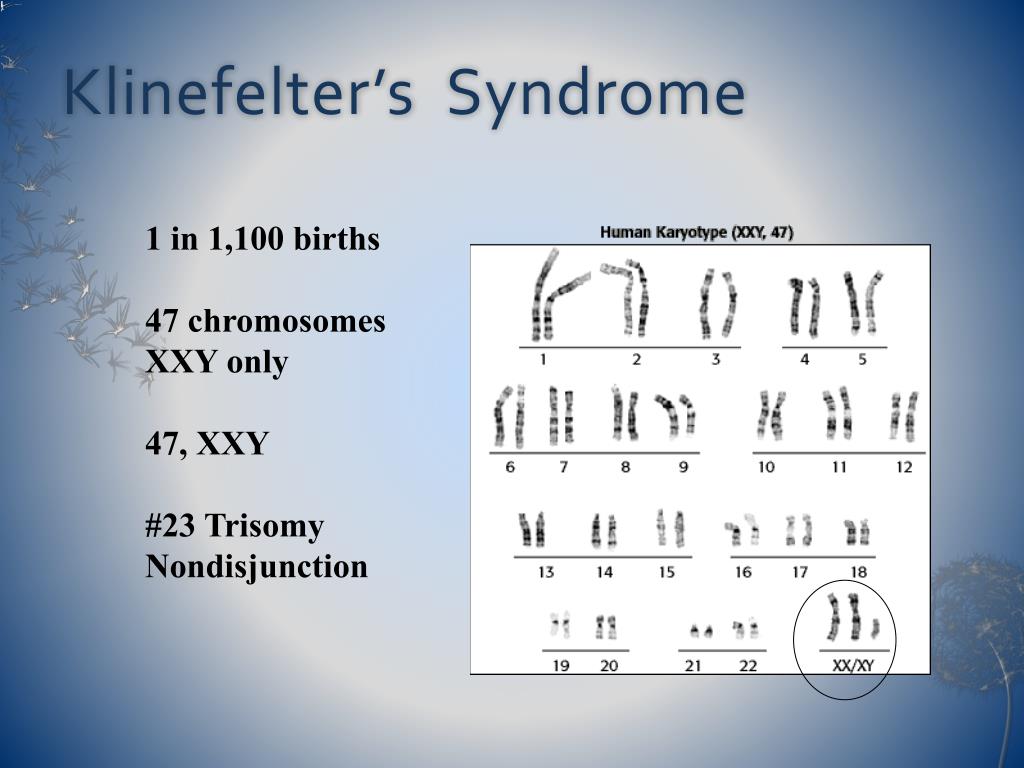 PPT - Nondisjunction disorders PowerPoint Presentation - ID:266480