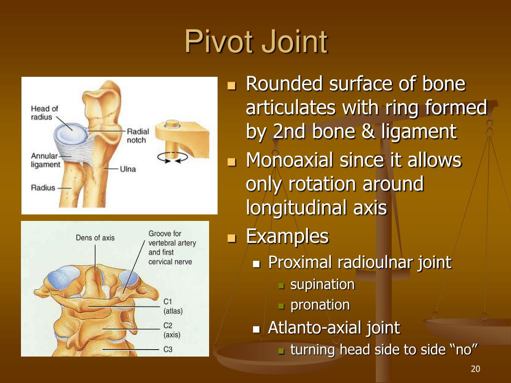 What Are 2 Examples Of Pivot Joints Mastery Wiki