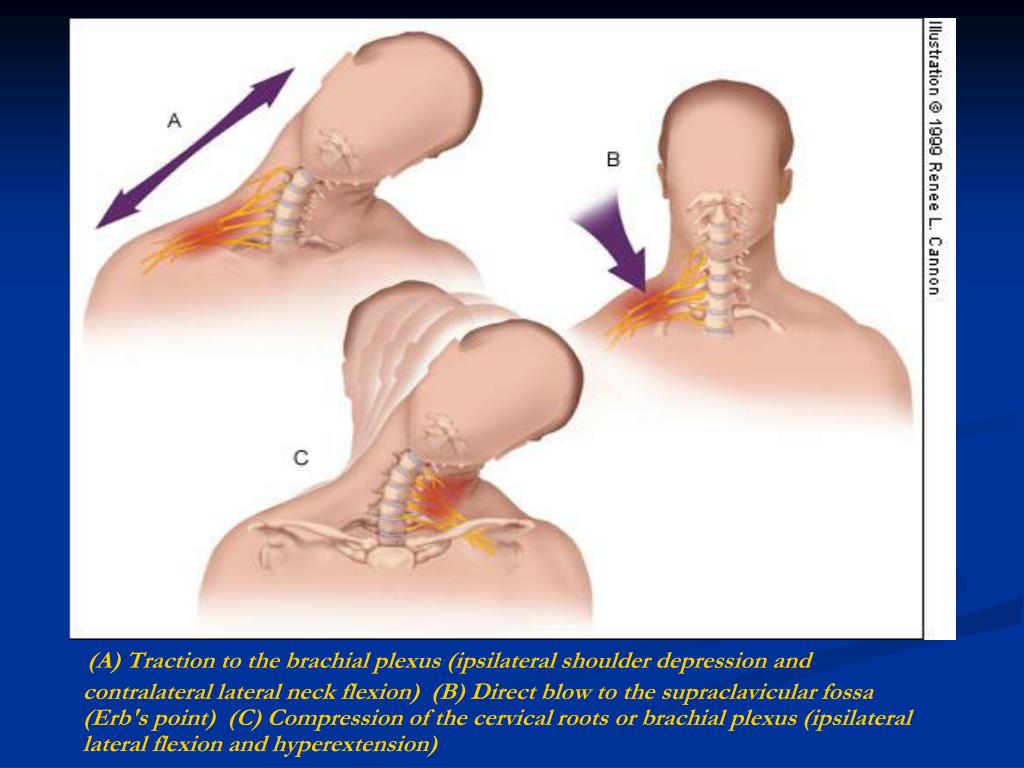 PPT - Cervical Spine Pathologies and Special Tests PowerPoint