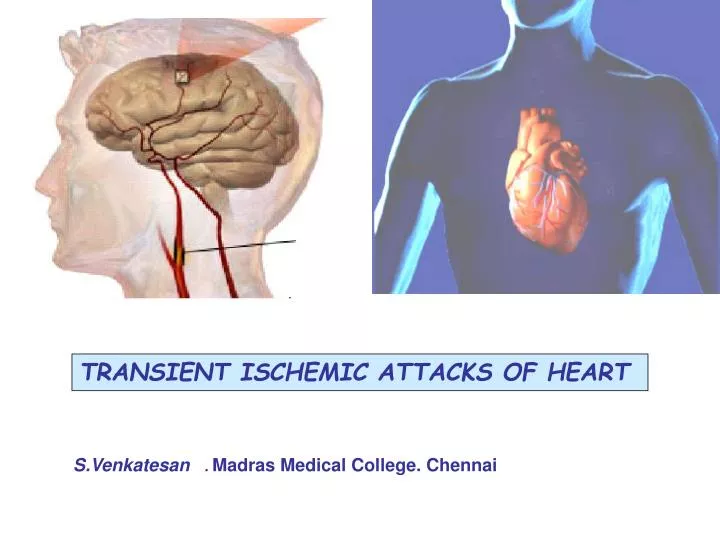 PPT TRANSIENT ISCHEMIC ATTACKS OF HEART PowerPoint Presentation, free