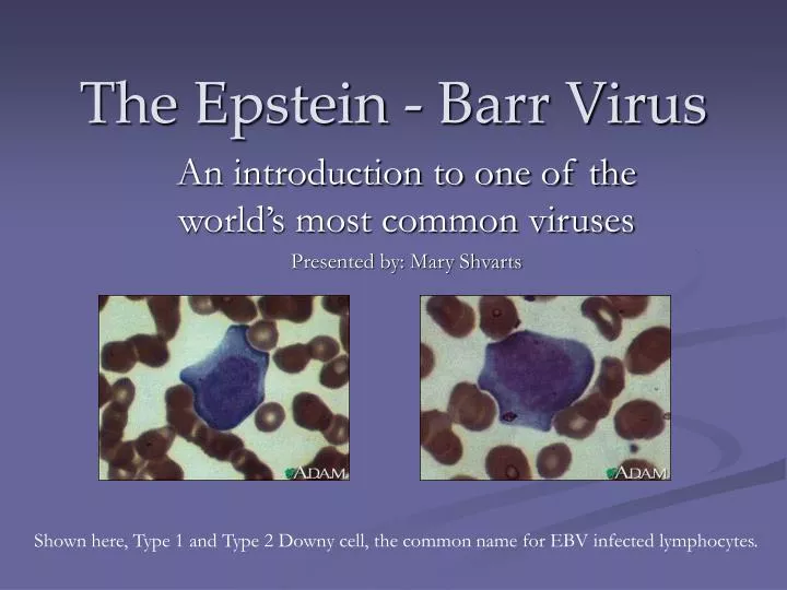 the epstein barr virus n.