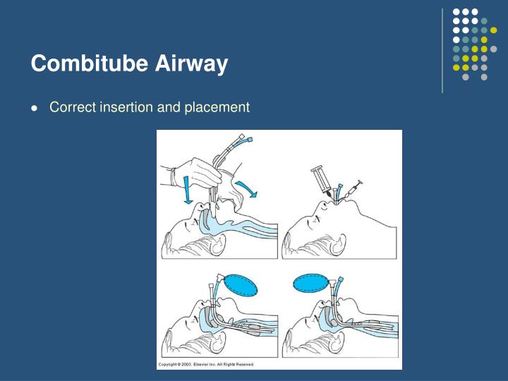 PPT - Airway Management Part I PowerPoint Presentation - ID:279323