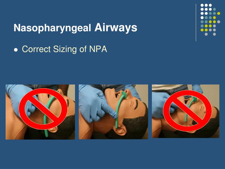 PPT - Airway Management Part I PowerPoint Presentation - ID:279323