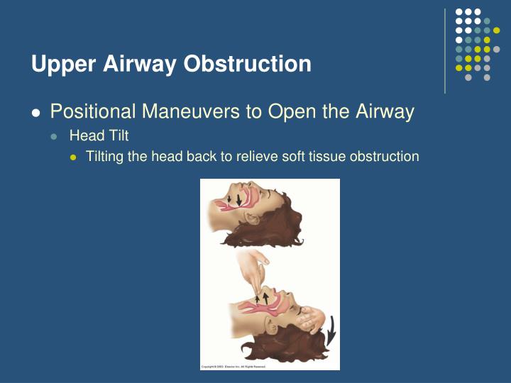 PPT - Airway Management Part I PowerPoint Presentation - ID:279323