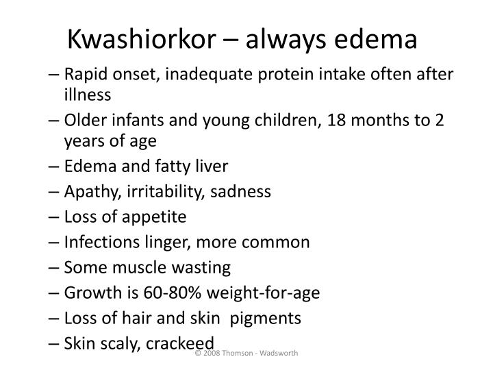 PPT ProteinEnergy Malnutrition (PEM) PowerPoint Presentation ID281396