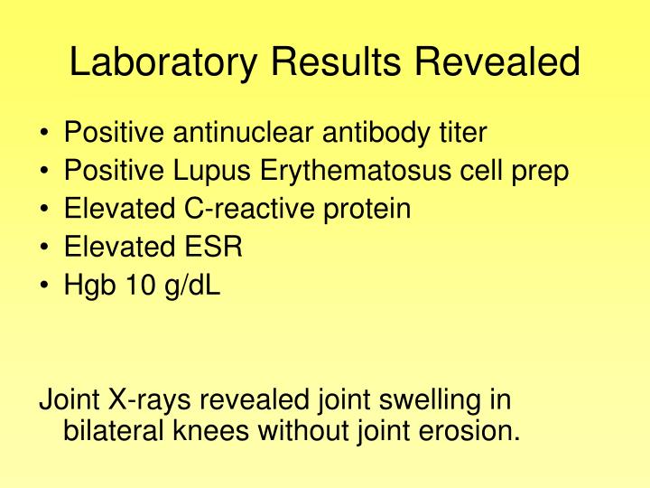 Abnormal Lupus Test Results : What Normal (and Abnormal) Urine Test ...