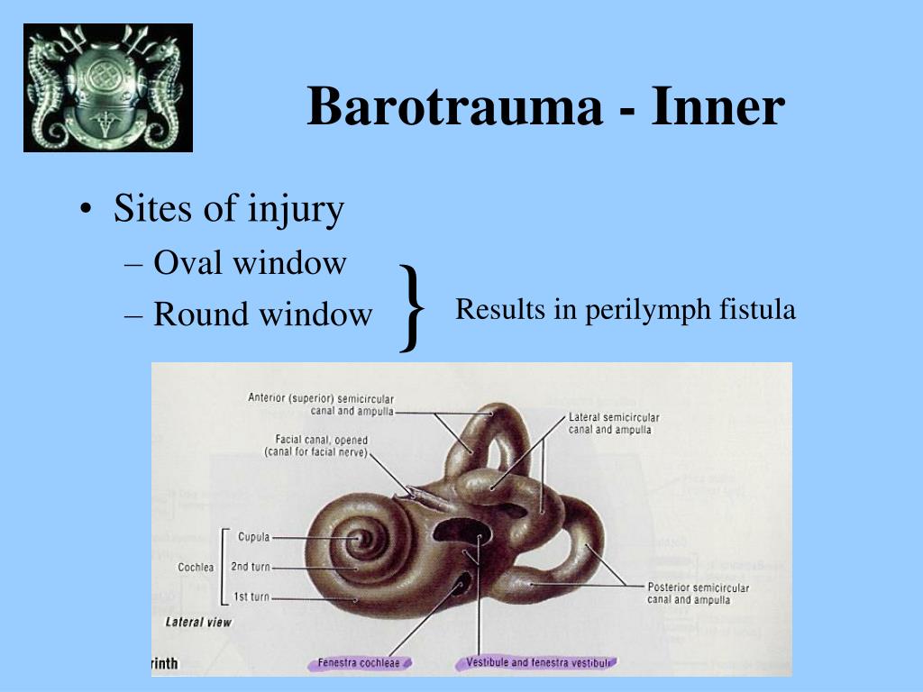diving barotrauma ear treatment