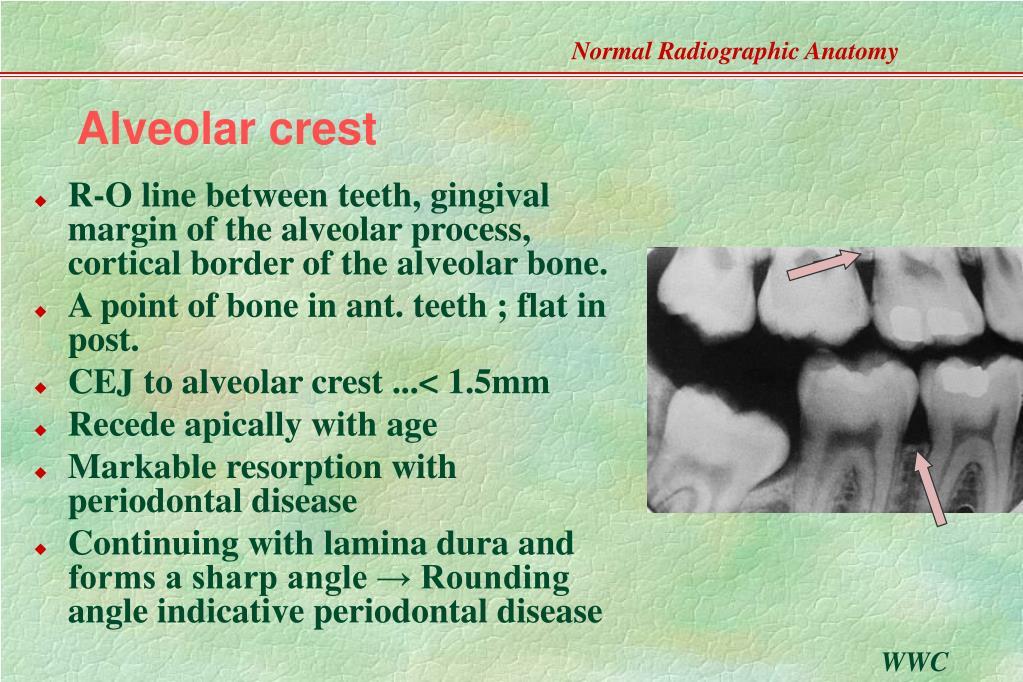 Ppt Normal Radiographic Anatomy Based On Intraoral Films Powerpoint