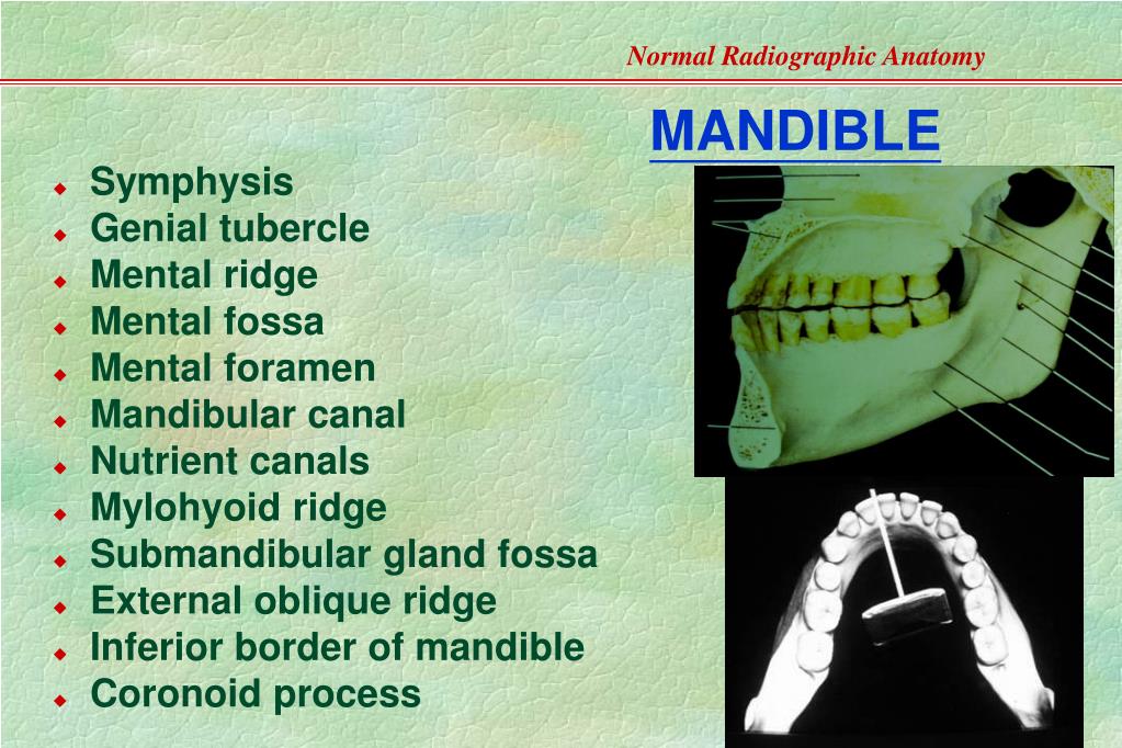 PPT - Normal Radiographic Anatomy- Based on Intraoral Films PowerPoint