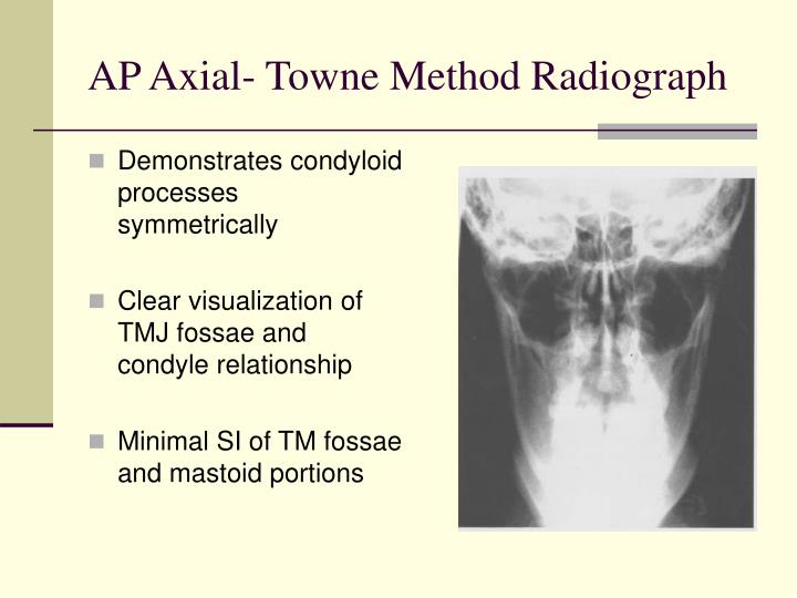 PPT Mandible & TMJ Lecture PowerPoint Presentation ID292789